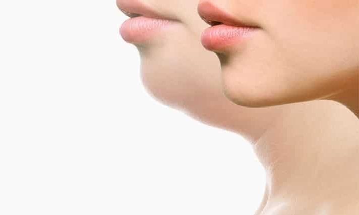 Fat-Dissolving-image