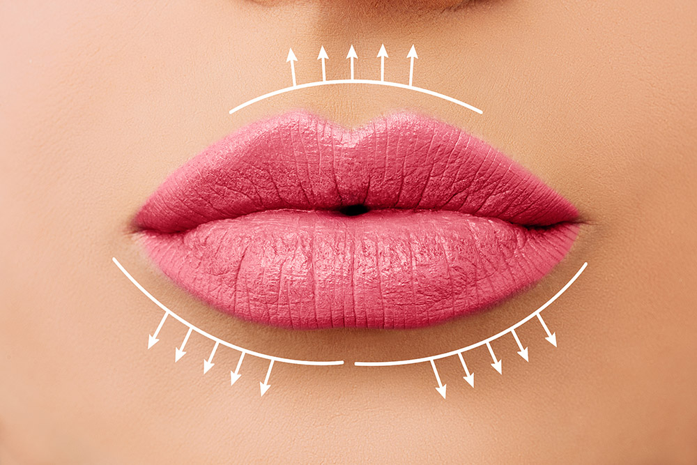 Beautiful woman lips before lip filler injections. Fillers, cosmetology, aesthetic surgery and lip augmentation concept