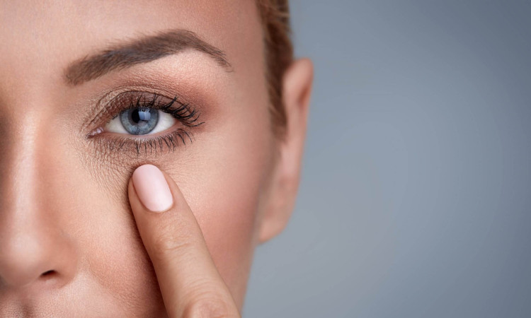 puffy-eyes