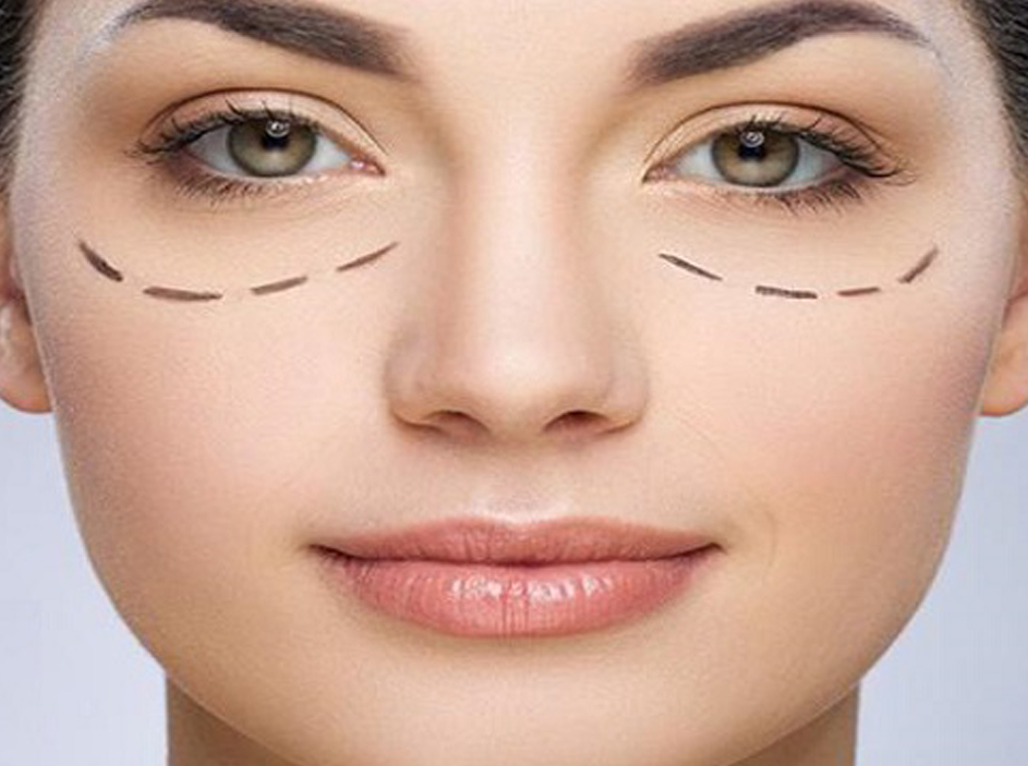 کربوکسی تراپی چشم 5