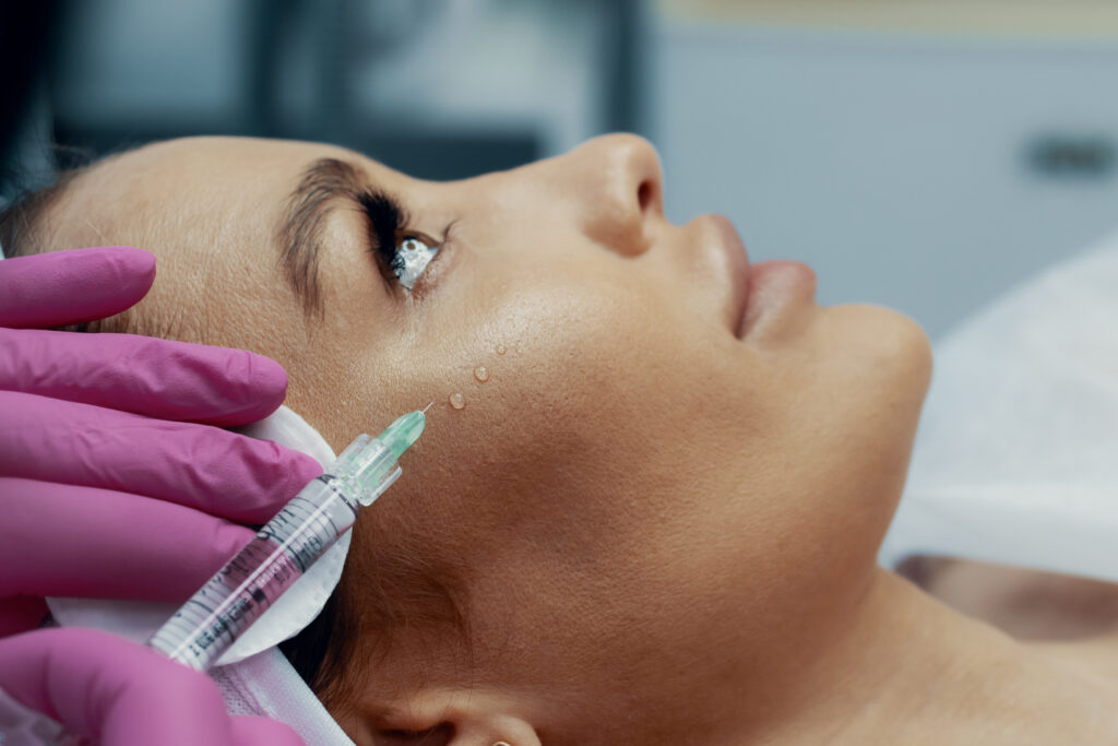 acne-filler-injection-1024x683